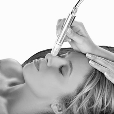 microdermabrasion